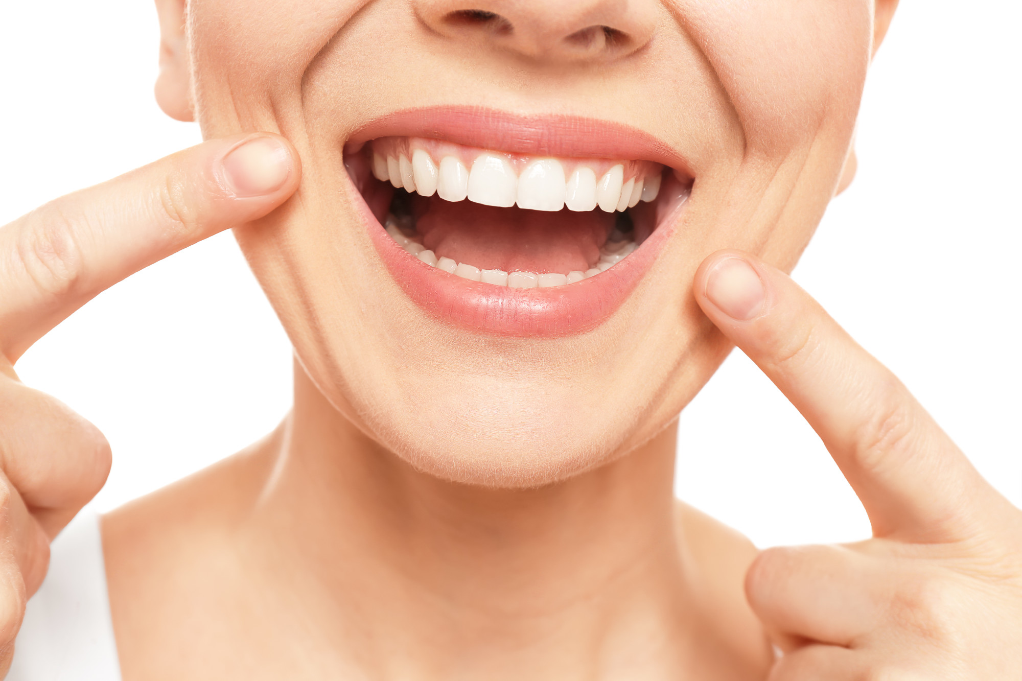 Smile design transformation result