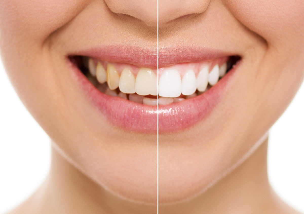 Comprehensive orthodontics consultation