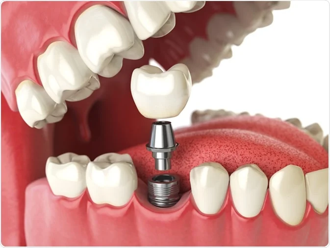 Painless extraction treatment room